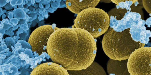 MRSA_Methicillin_Resistant_Staphylococcus_Aureus.jpg